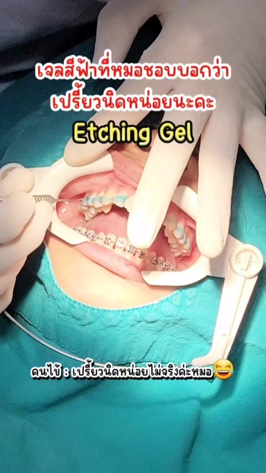 TikTok video thumbnail by toothgo