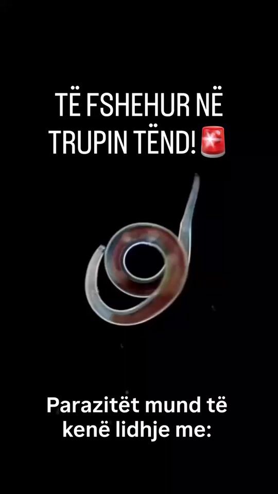 TikTok video thumbnail by adenaa.al