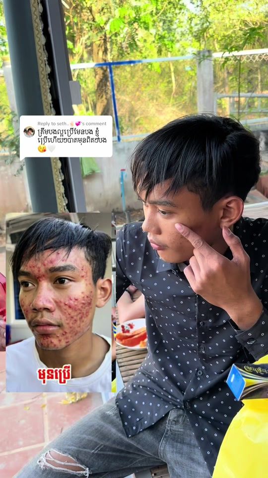TikTok video thumbnail by dorn0103