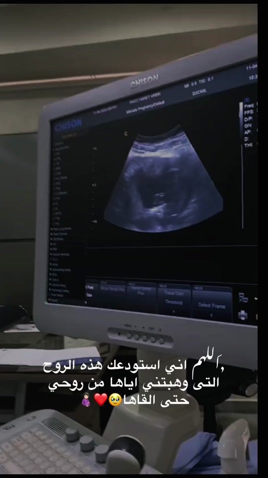 TikTok video thumbnail by ola_saleh440