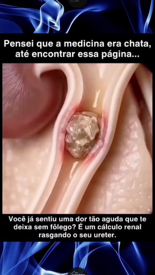 TikTok video thumbnail by mestredeobra_