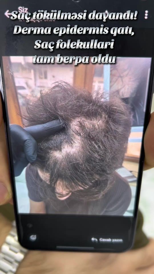 TikTok video thumbnail by _dr_aga