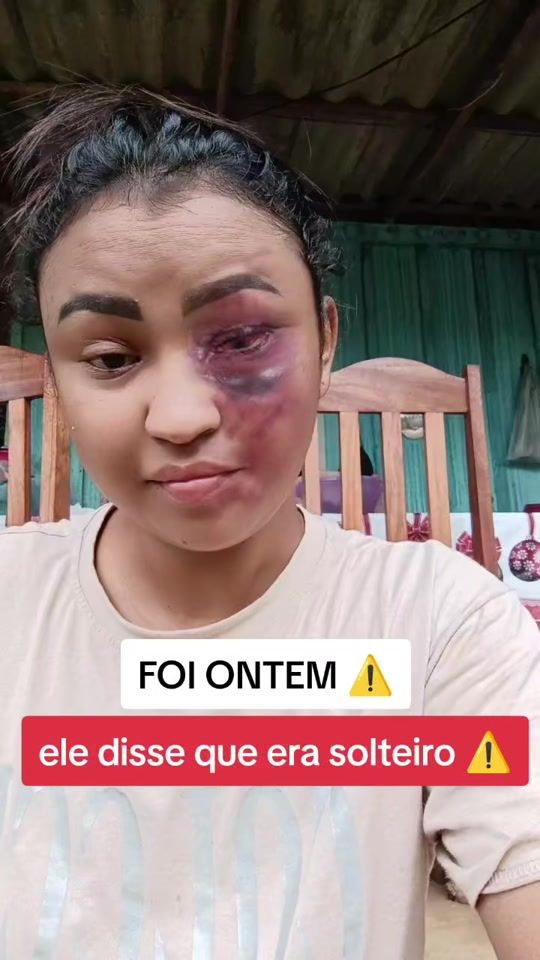 TikTok video thumbnail by lary.limaa9