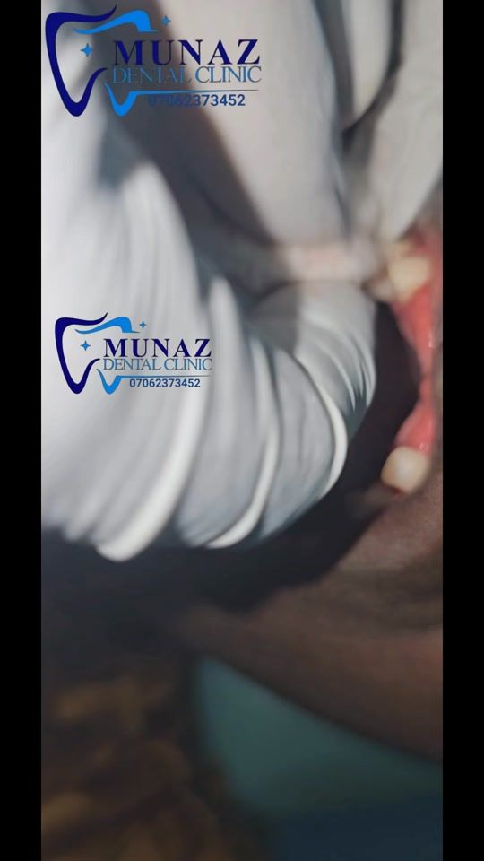 TikTok video thumbnail by rdth_abdallah