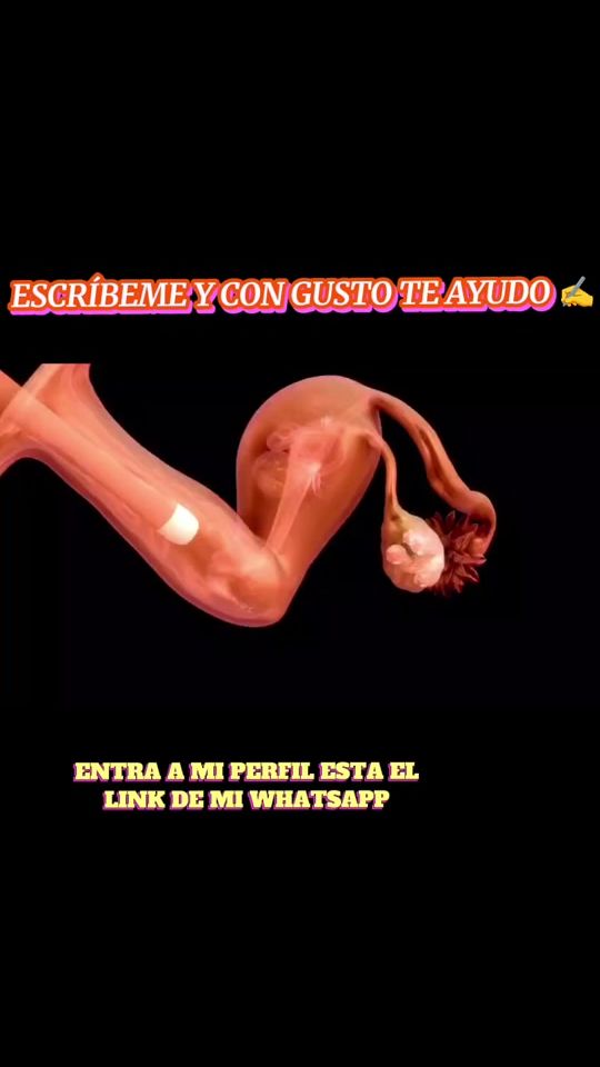 TikTok video thumbnail by fertilidad.50