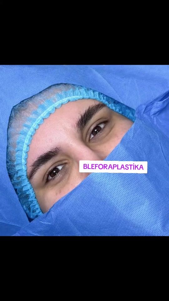 TikTok video thumbnail by uzman.doktorlar
