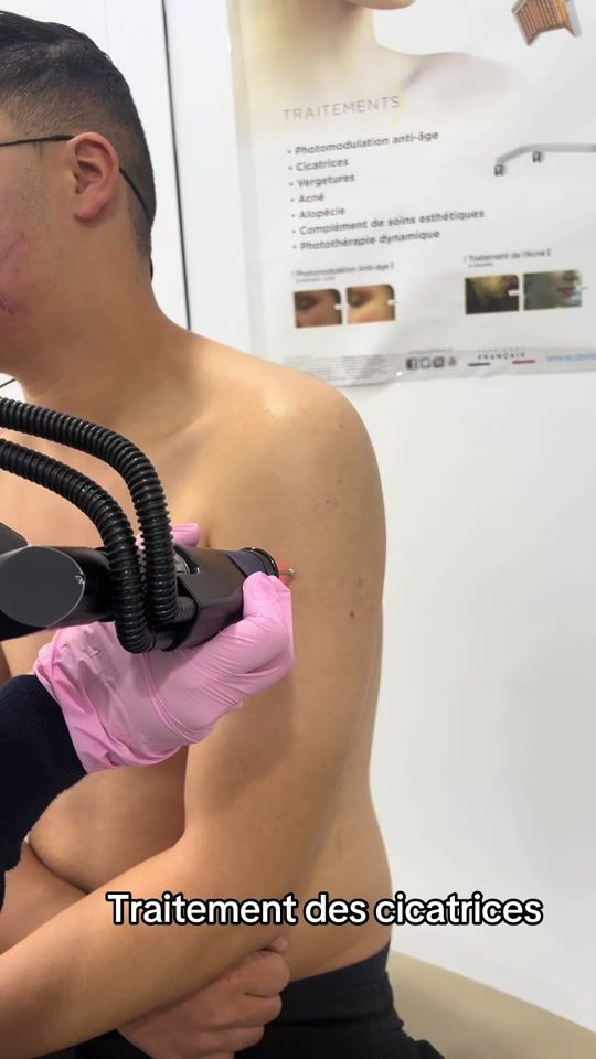 TikTok video thumbnail by dr.chaallel