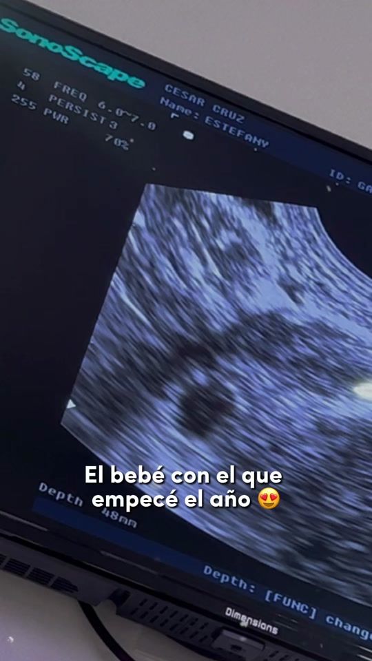 TikTok video thumbnail by jhanna_hr