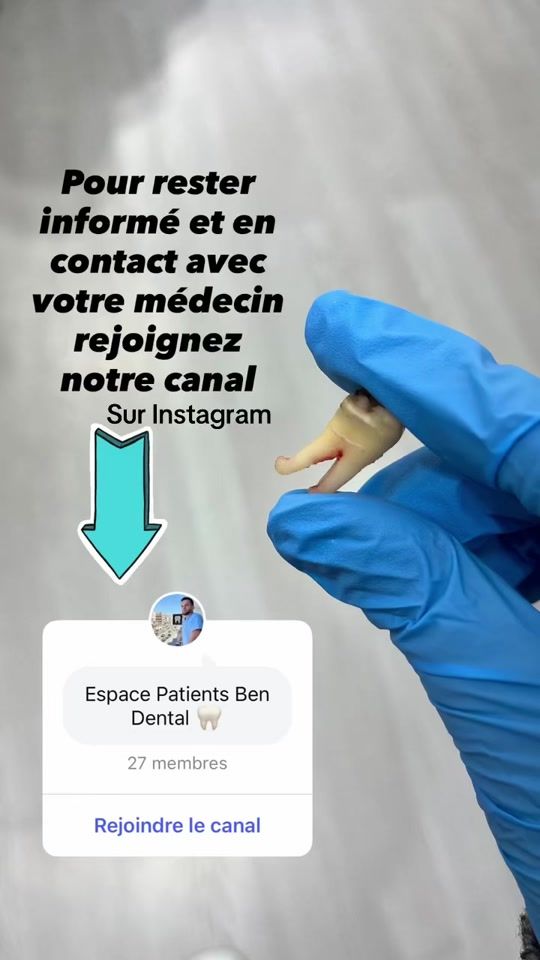 TikTok video thumbnail by dr.ben_anis