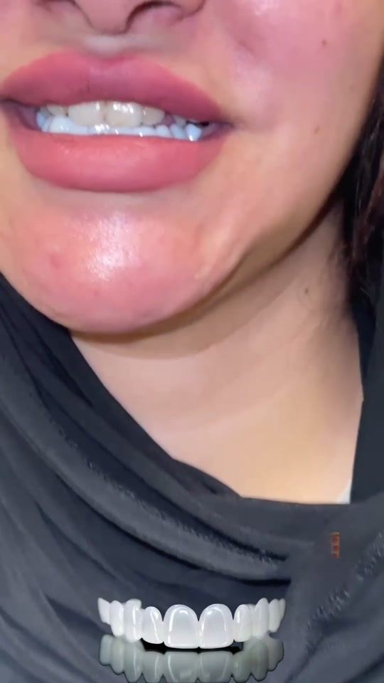 TikTok video thumbnail by dr.muhammad.mostafa