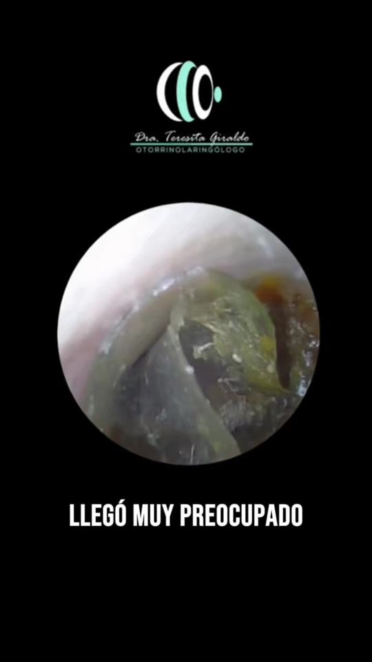TikTok video thumbnail by drateresita