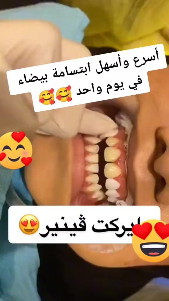 TikTok video thumbnail by smile.morocco4