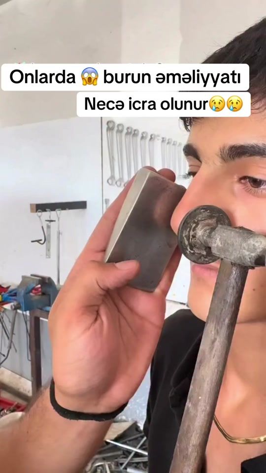 TikTok video thumbnail by dr.rino.med