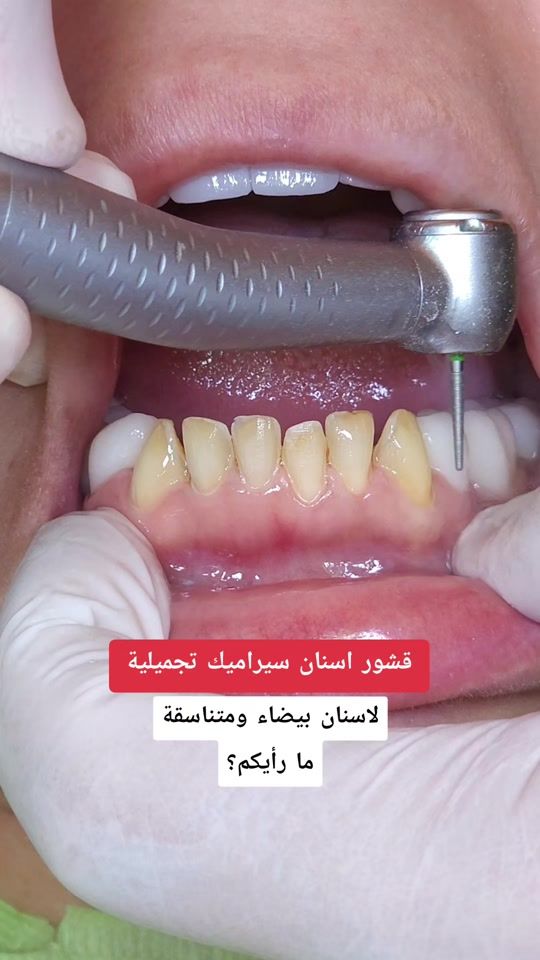 TikTok video thumbnail by dreliegemaa