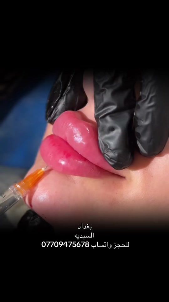 TikTok video thumbnail by karada.clinic