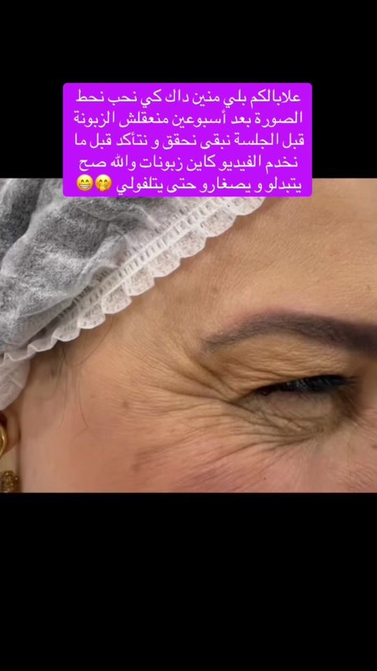 TikTok video thumbnail by randa_194