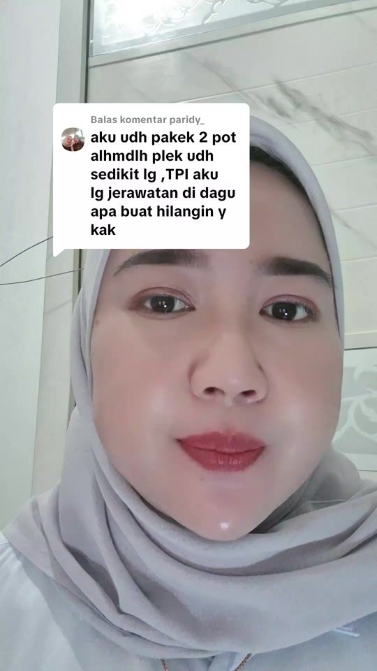TikTok video thumbnail by ig.e.rosarina
