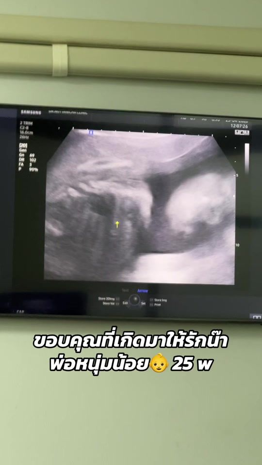 TikTok video thumbnail by 22dayday.__