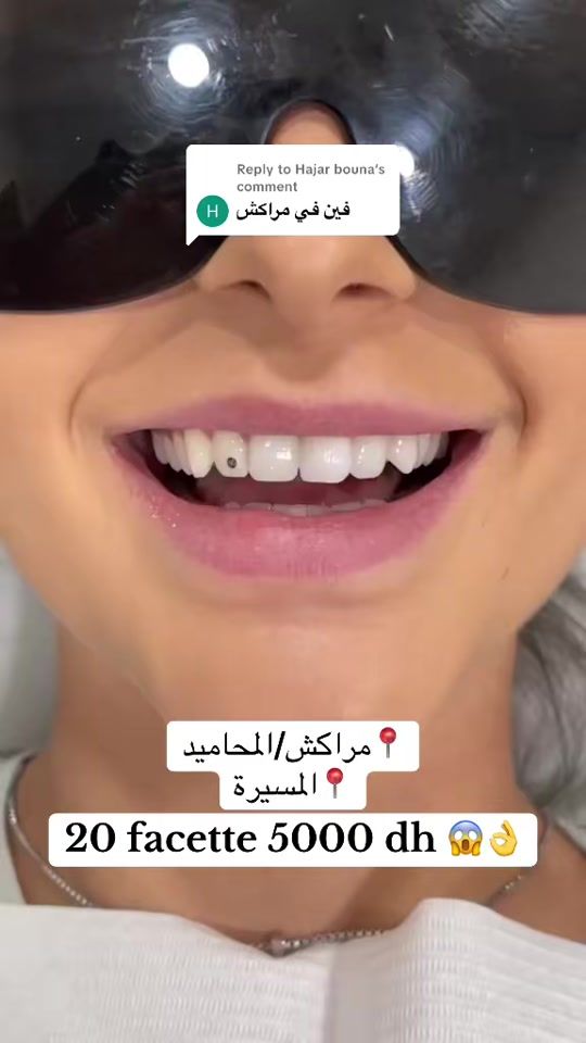TikTok video thumbnail by kldigital.smile