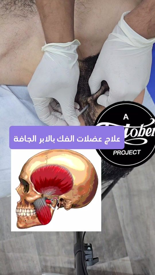 TikTok video thumbnail by dptaziz