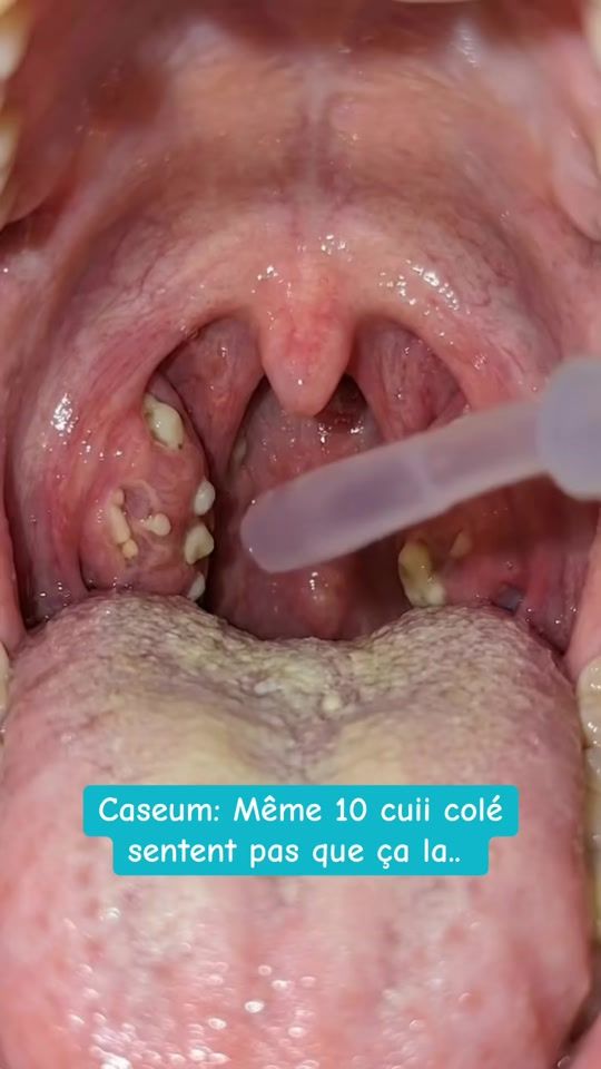 TikTok video thumbnail by lesconseilsdelemey