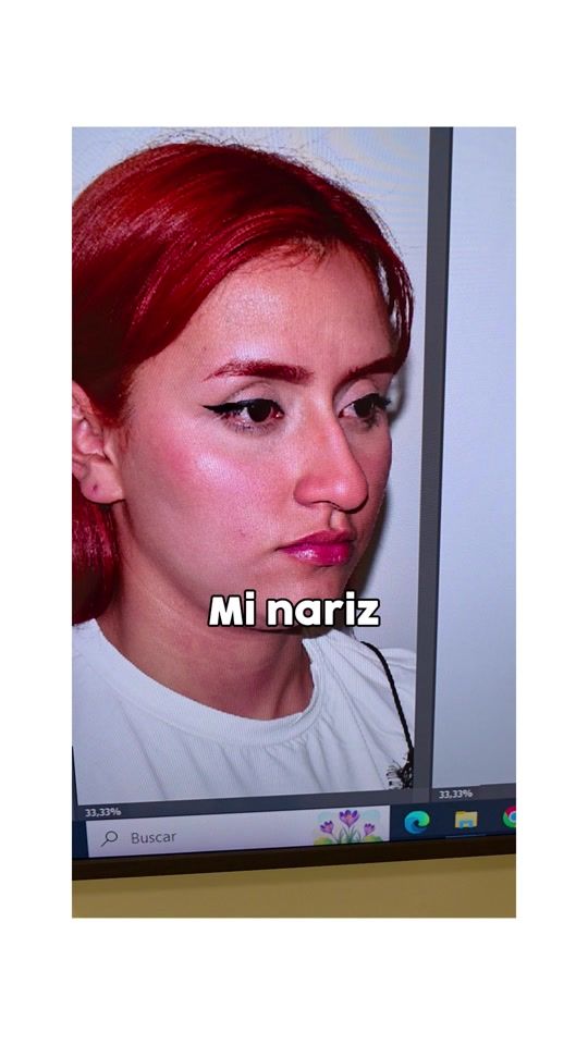 TikTok video thumbnail by drgermanbernal