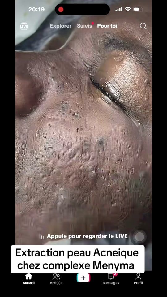 TikTok video thumbnail by institut_menyma_beaute