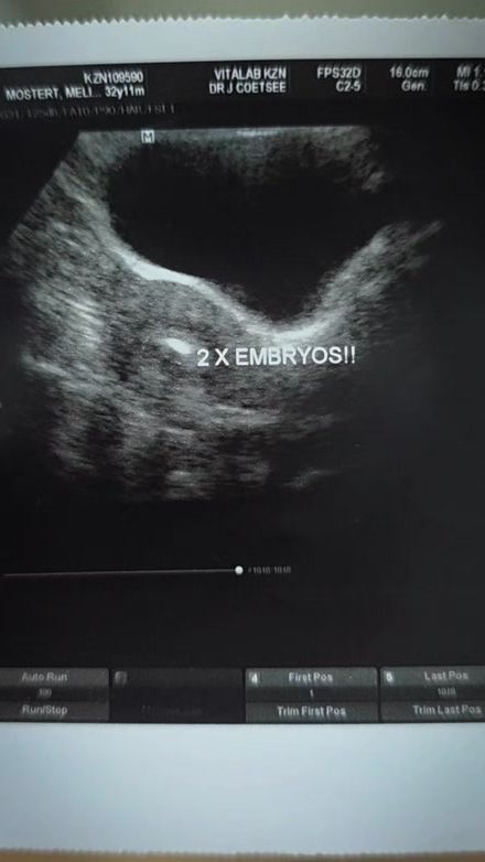TikTok video thumbnail by melissamostert