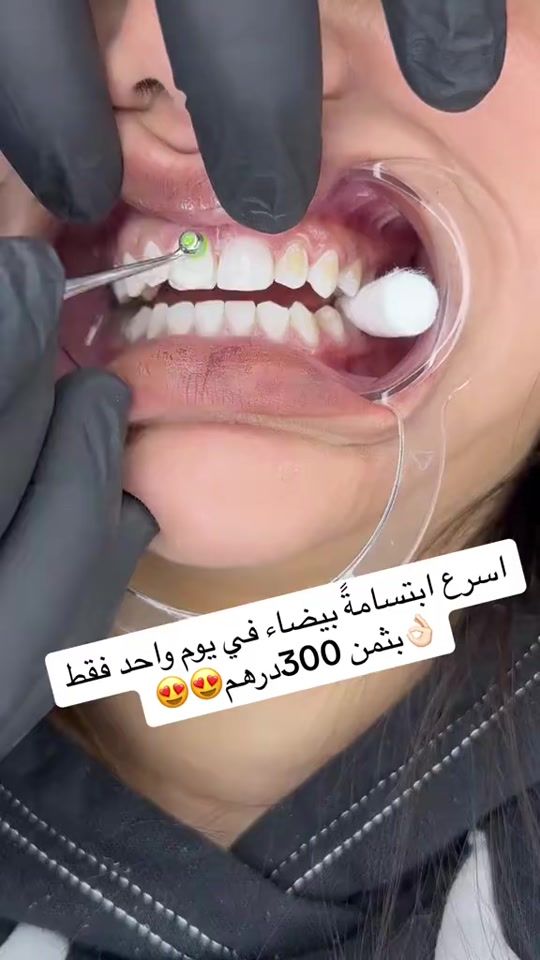 TikTok video thumbnail by kldigital.smile