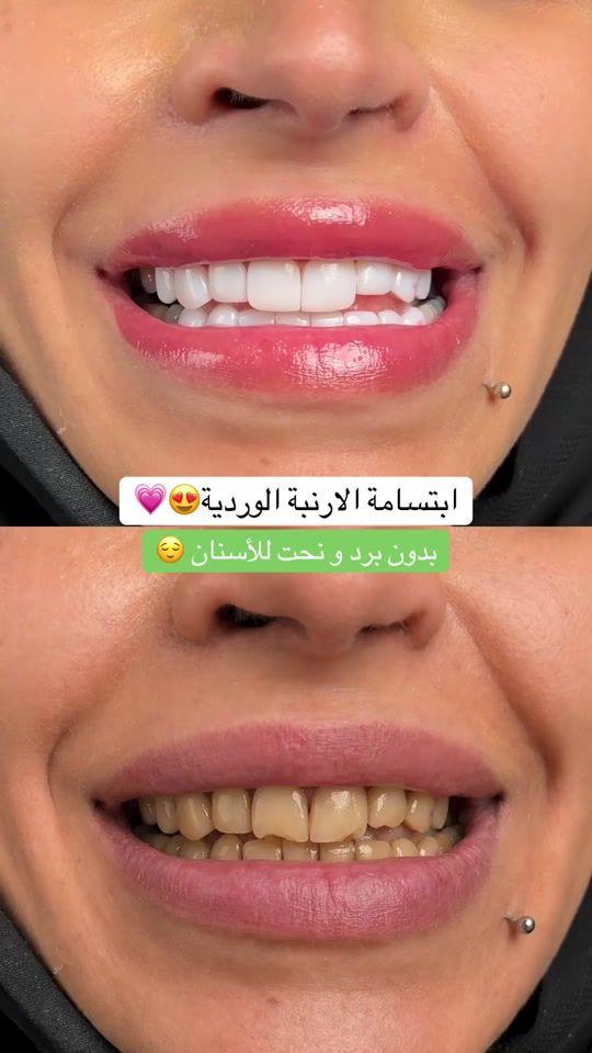TikTok video thumbnail by albaclinics