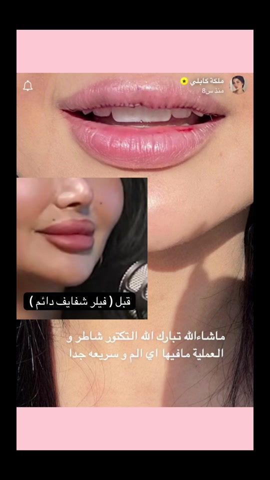 TikTok video thumbnail by malak97m1