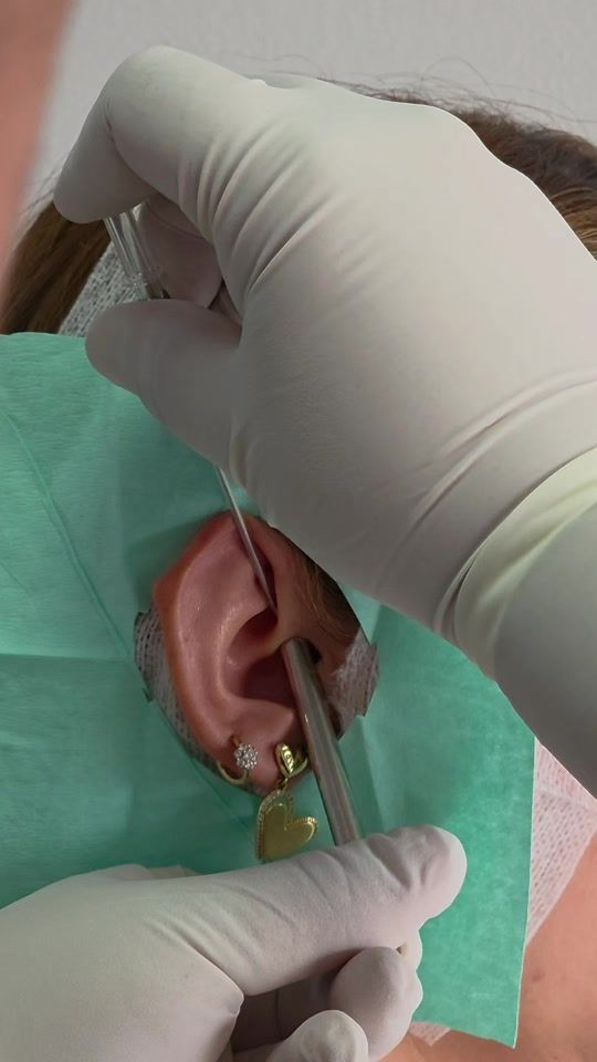 TikTok video thumbnail by perforaciondeoreja
