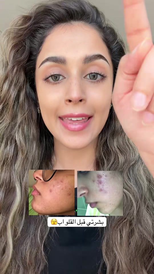 TikTok video thumbnail by roma1999i
