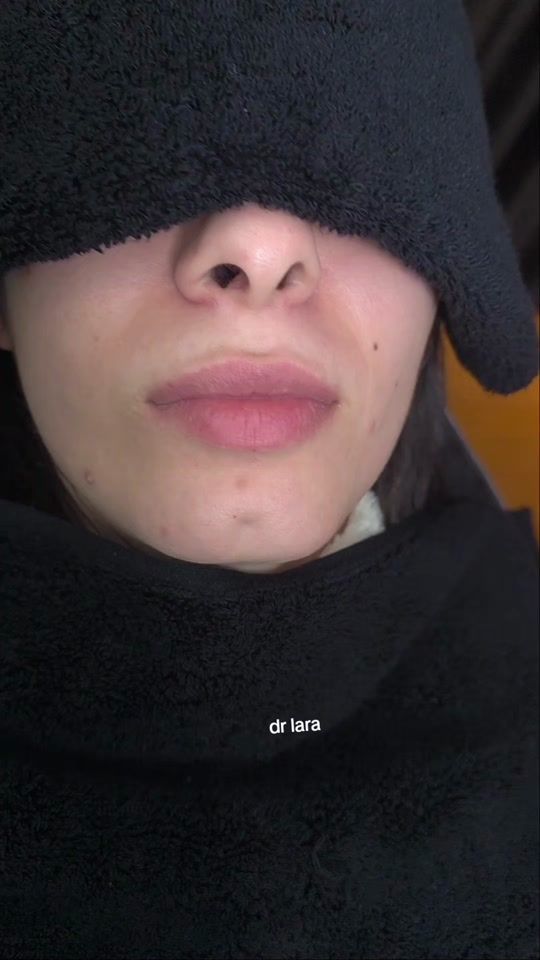 TikTok video thumbnail by dr.laracheaito