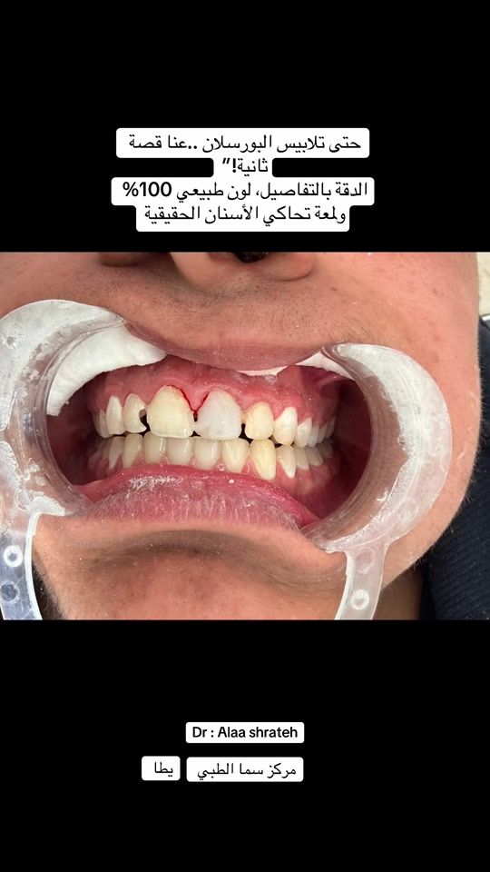 TikTok video thumbnail by alaa_shrateh