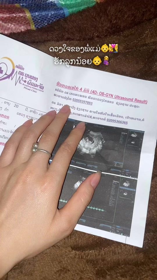 TikTok video thumbnail by ____20663