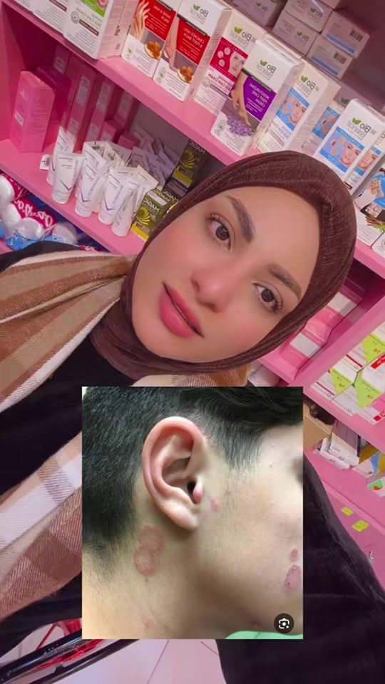 TikTok video thumbnail by reham.nadhim.abada