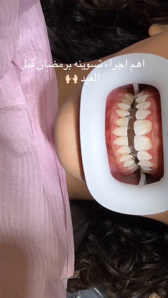 TikTok video thumbnail by jzxi77