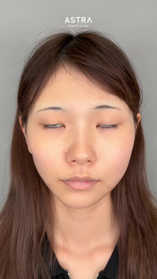TikTok video thumbnail by dr.shiomitsu