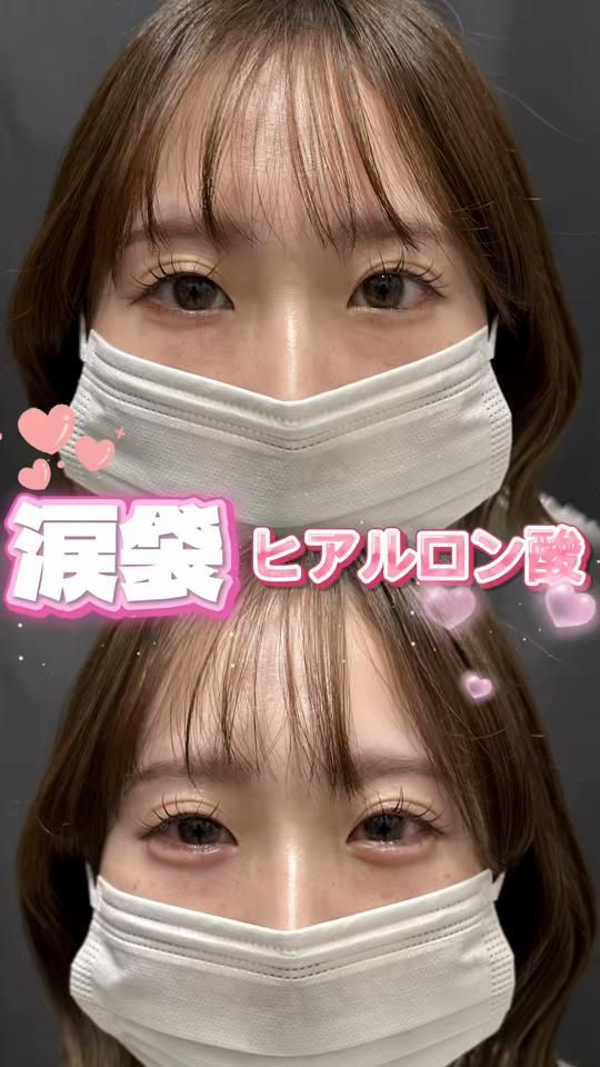 TikTok video thumbnail by lulachiba