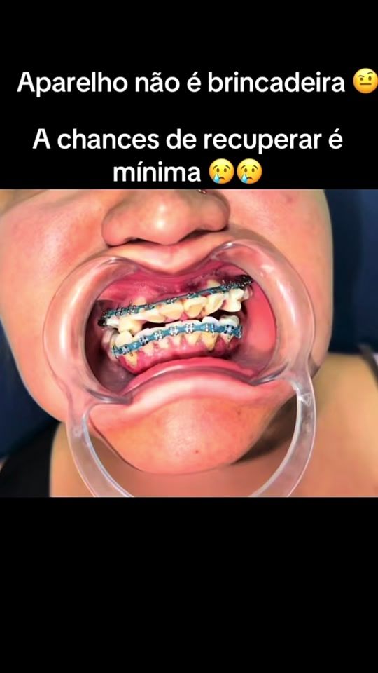 TikTok video thumbnail by ortocenter