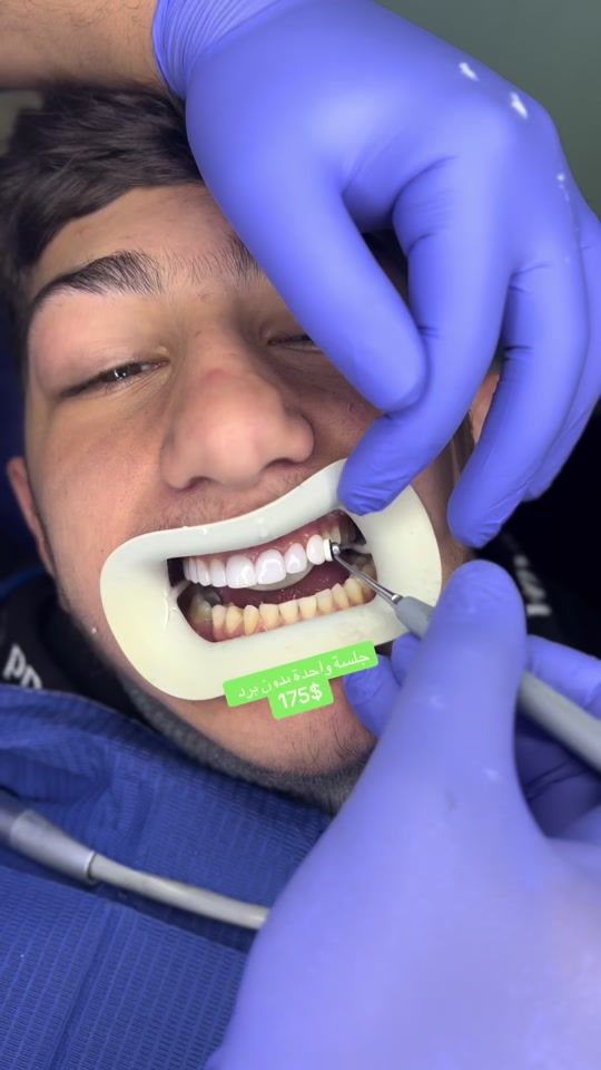 TikTok video thumbnail by clinics2020