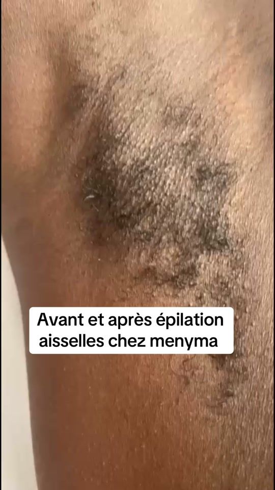 TikTok video thumbnail by institut_menyma_beaute