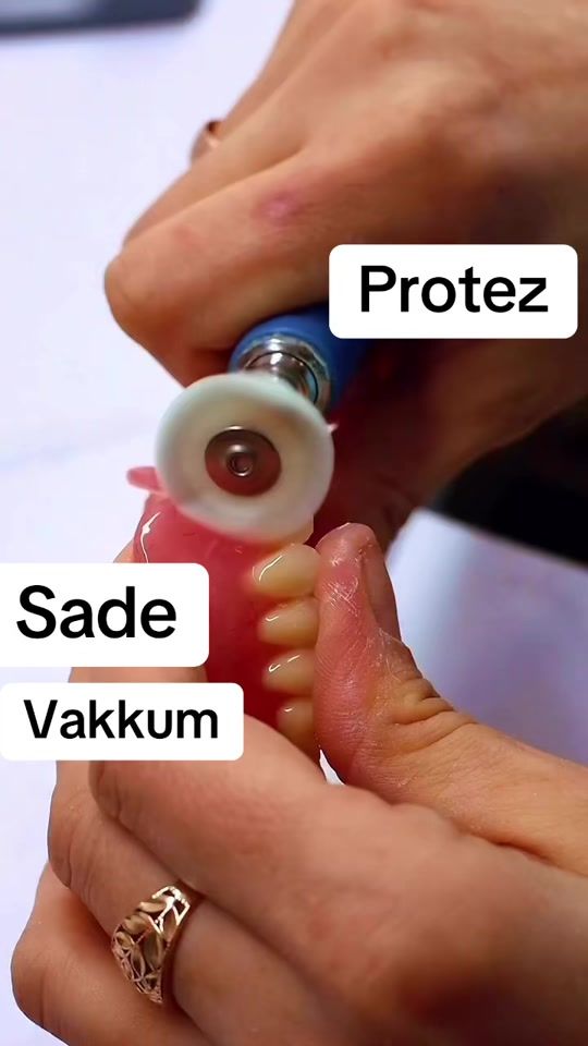 TikTok video thumbnail by dentist_gunel
