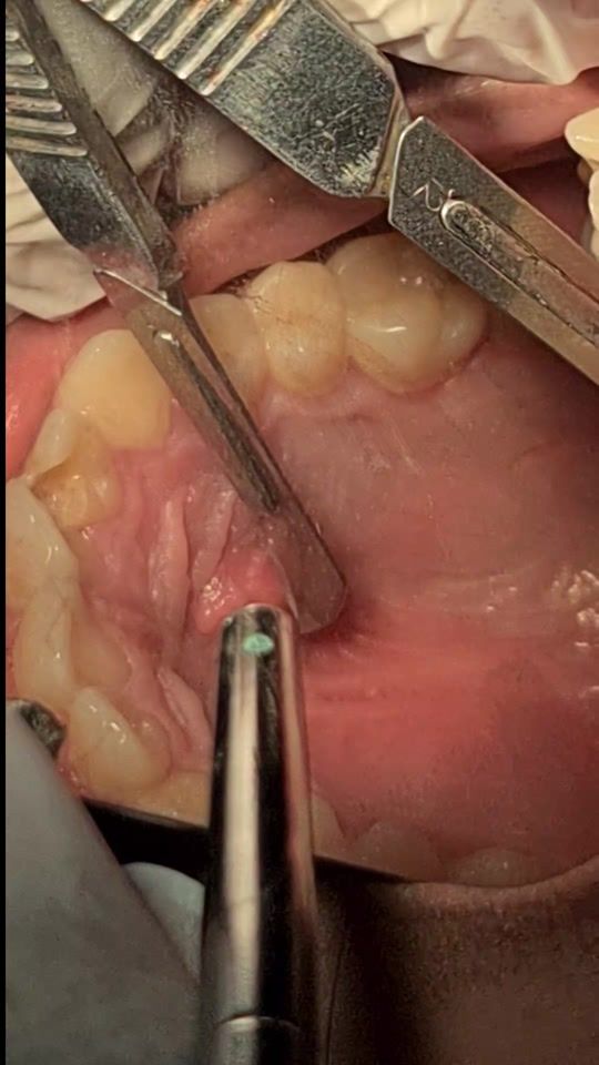 TikTok video thumbnail by dr.donoso