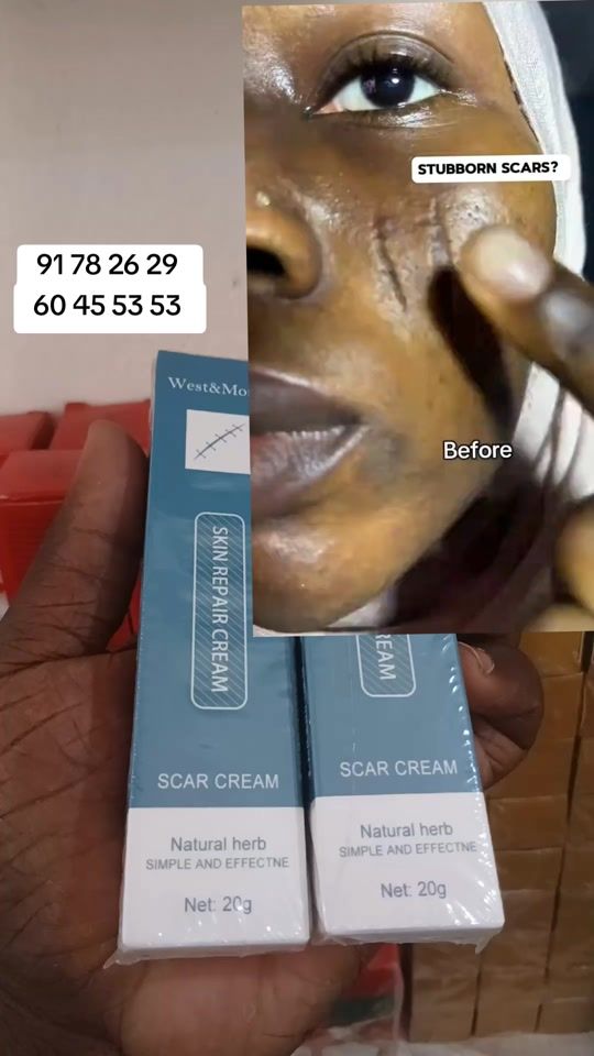TikTok video thumbnail by ecommerce.birra.a