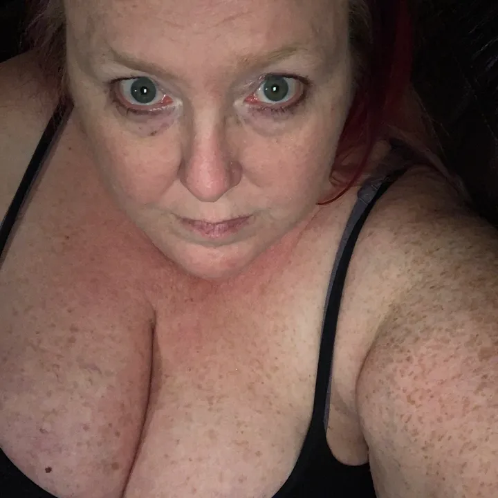 @curvyredfrog - 🐸Curvyredfrog🐸