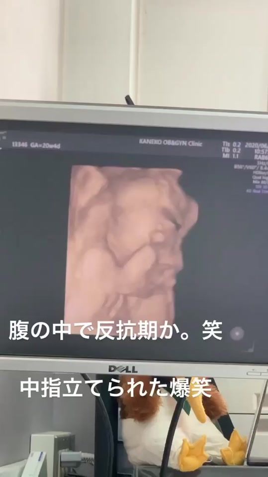 TikTok video thumbnail by r_11042